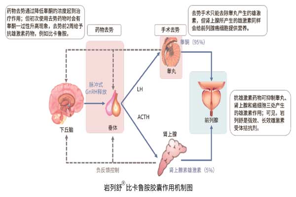 前列腺癌,J9集团,比卡鲁胺胶囊